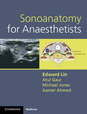 Sonoanatomy for Anaesthetists - Edward Lin, Atul Gaur, Michael Jones, Aamer Ahmed