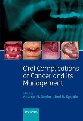 Oral Complications of Cancer and its Management - 