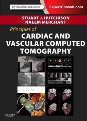 Principles of Cardiac and Vascular Computed Tomography - Stuart J. Hutchison, Naeem Merchant
