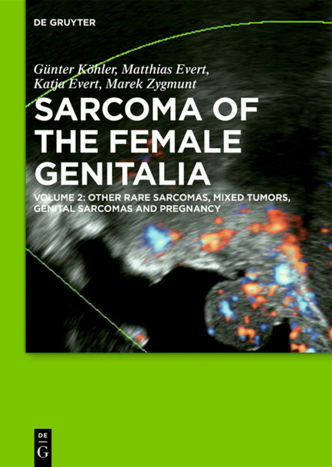 Sarcoma of the Female Genitalia / [Set Vol. I+II] - Günter Köhler, Matthias Evert, Katja Evert, Marek Zygmunt