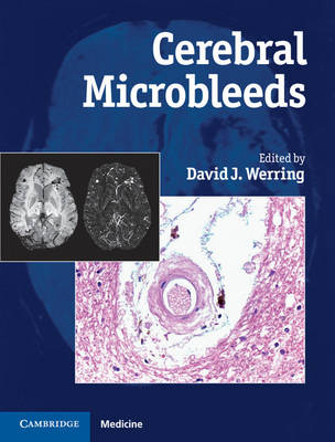 Cerebral Microbleeds - 