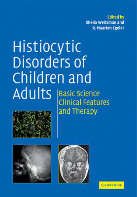 Histiocytic Disorders of Children and Adults - 