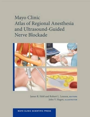Mayo Clinic Atlas of Regional Anesthesia and Ultrasound-Guided Nerve Blockade - James Hebl, Robert Lennon