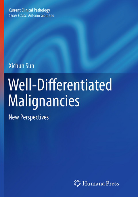 Well-Differentiated Malignancies - Xichun Sun