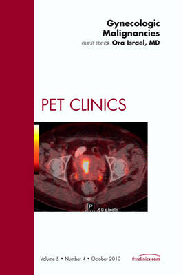 Gynecologic Malignancies, An Issue of PET Clinics - Ora Israel