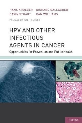 HPV and Other Infectious Agents in Cancer - Hans Krueger, Gavin Stuart, Richard Gallagher, Dan Williams, Jon Kerner