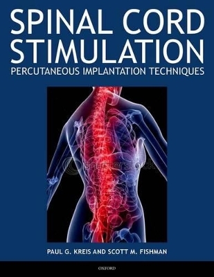 Spinal Cord Stimulation - Paul Kreis, Scott Fishman