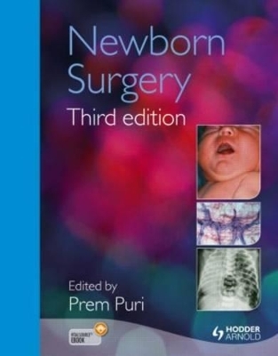 Newborn Surgery 3E - Prem Puri