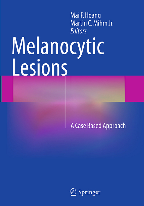 Melanocytic Lesions - 