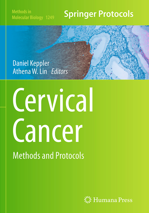 Cervical Cancer - 