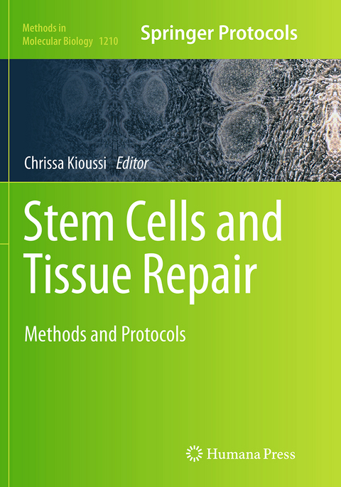 Stem Cells and Tissue Repair - 