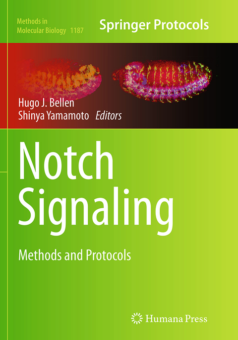 Notch Signaling - 