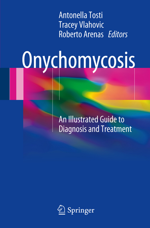 Onychomycosis - 