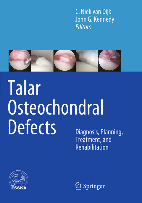 Talar Osteochondral Defects - 