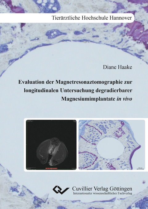Evaluation der Magnetresonaztomographie zur longitudinalen Untersuchung degradierbarer Mag-nesiumimplantate in vivo - Diane Haake