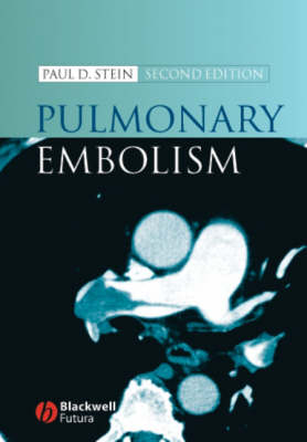 Pulmonary Embolism -  Stein