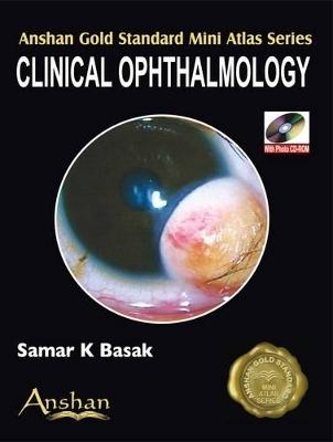 Mini Atlas of Clinical Ophthalmology - Samar K. Basak, Amar Agarwal