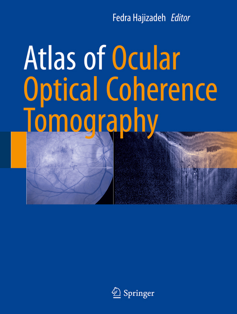Atlas of Ocular Optical Coherence Tomography - 