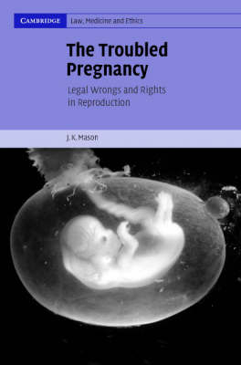 The Troubled Pregnancy - J. K. Mason
