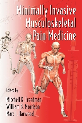 Minimally Invasive Musculoskeletal Pain Medicine - 