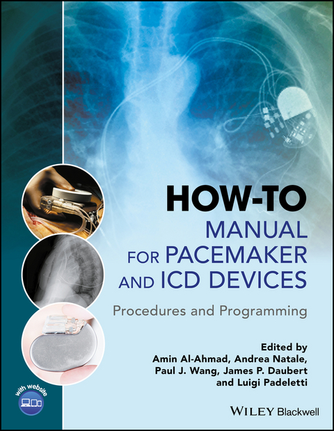 How-to Manual for Pacemaker and ICD Devices - 