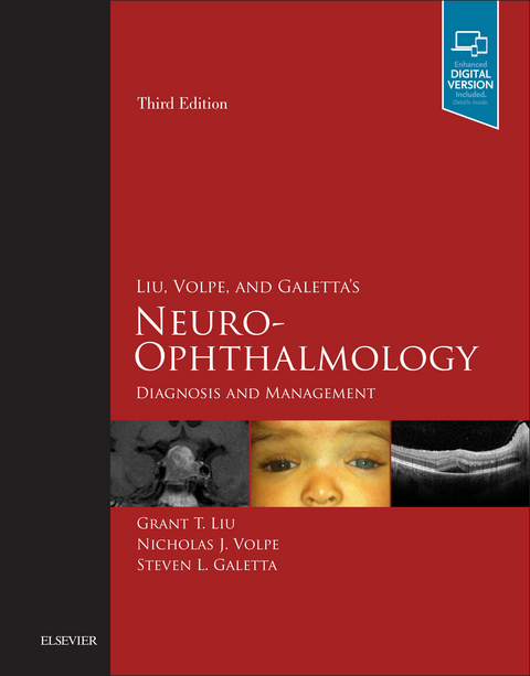 Liu, Volpe, and Galetta's Neuro-Ophthalmology E-Book -  Steven L. Galetta,  Grant T. Liu,  Nicholas J. Volpe