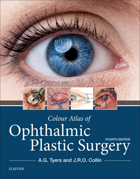 Colour Atlas of Ophthalmic Plastic Surgery -  J. R. O. Collin,  Anthony G. Tyers