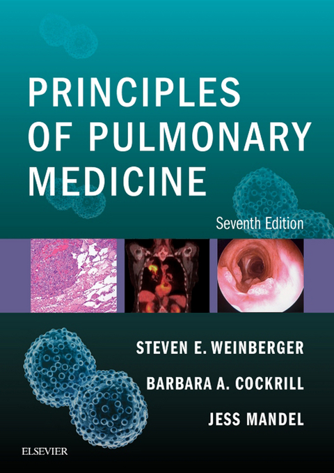 Principles of Pulmonary Medicine -  Barbara A. Cockrill,  Jess Mandel,  Steven E. Weinberger