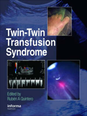 Twin-Twin Transfusion Syndrome - 