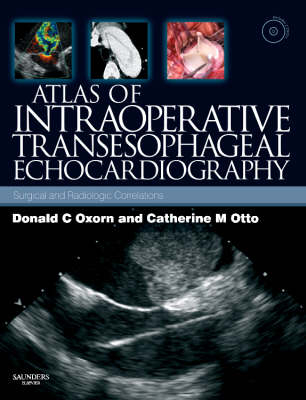 Atlas of Intraoperative Transesophageal Echocardiography - Donald Oxorn, Catherine M. Otto
