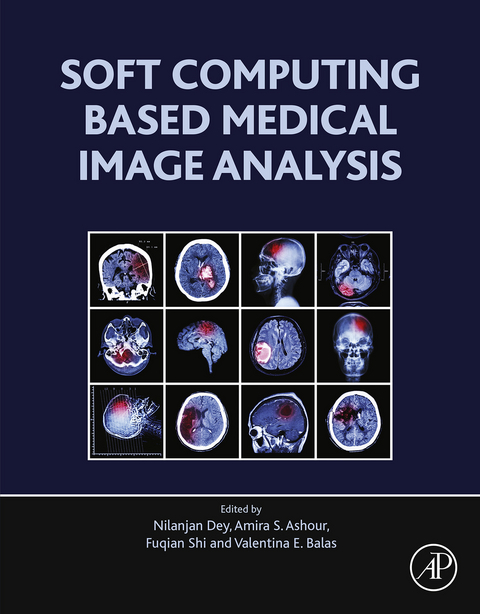 Soft Computing Based Medical Image Analysis -  Nilanjan Dey,  Amira S. Ashour,  Fuquian Shi,  Valentina Emilia Balas