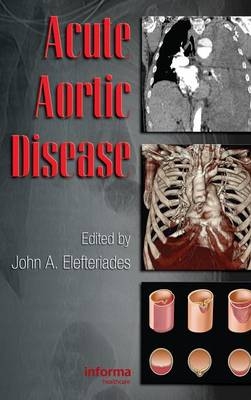 Acute Aortic Disease - 