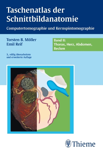 Taschenatlas der Schnittbildanatomie - Torsten Bert Möller, Emil Reif