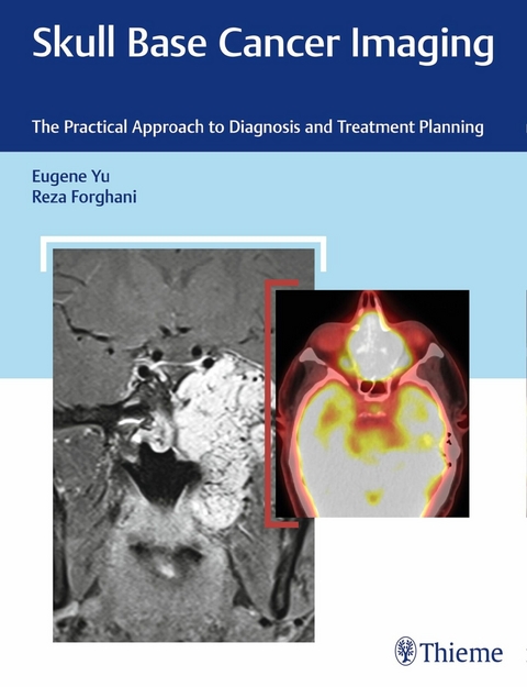 Skull Base Cancer Imaging - Eugene Yu, Reza Forghani