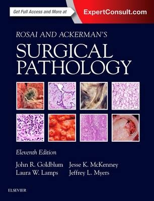 Rosai and Ackerman's Surgical Pathology E-Book -  John R. Goldblum,  Laura W. Lamps,  Jesse K. McKenney