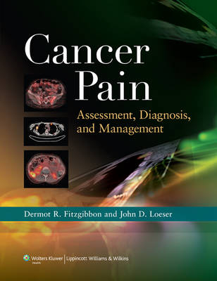 Cancer Pain: Assessment, Diagnosis, and Management - Dermot R. Fitzgibbon, John D. Loeser