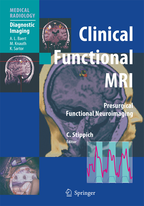 Clinical Functional MRI - 