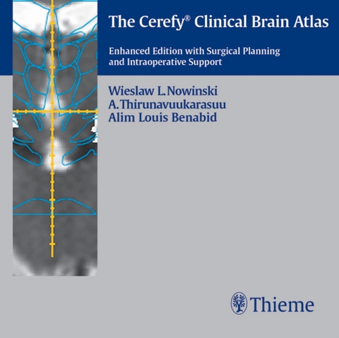 The Cerefy Clinical Brain Atlas/CD-ROM -  Nowinski