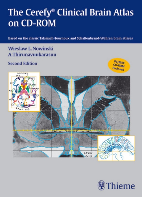 The Cerefy Clinical Brain Atlas on CD-ROM - Wieslaw L Nowinski, A Thirunavuukarasuu