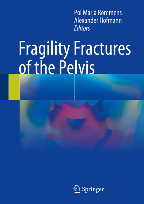 Fragility Fractures of the Pelvis - 