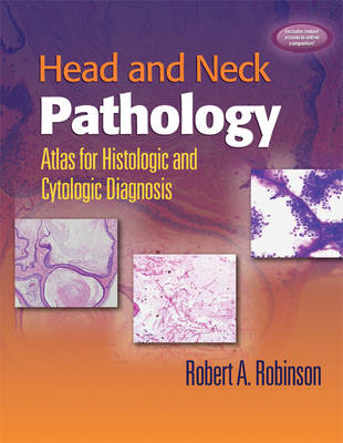 Head and Neck Pathology - Robert A. Robinson