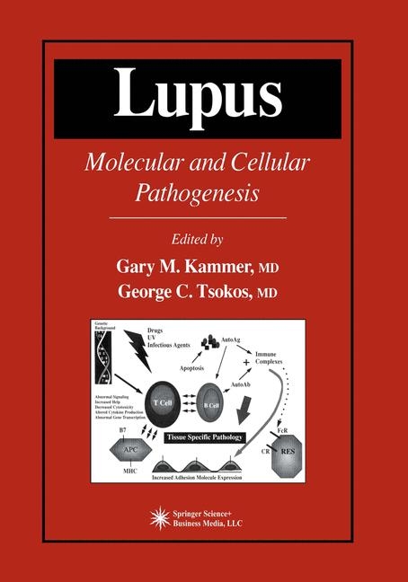 Lupus - 