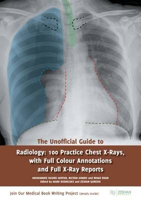 Unofficial Guide to Radiology -  Mohammed Rashid Aktar