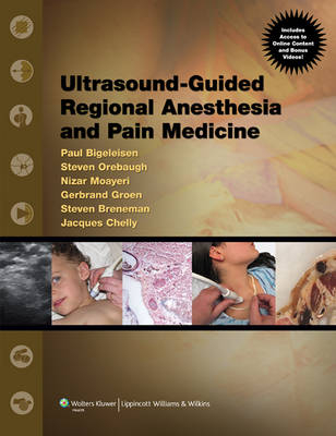 Ultrasound Guided Regional Anesthesia and Pain Medicine - 