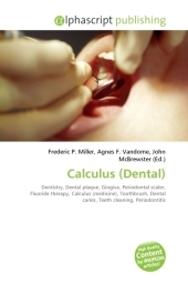 Calculus (Dental) - 