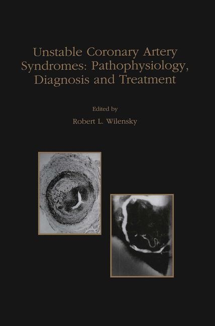 Unstable Coronary Artery Syndromes Pathophysiology, Diagnosis and Treatment -  Robert L. Wilensky