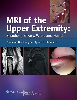 MRI of the Upper Extremity - 