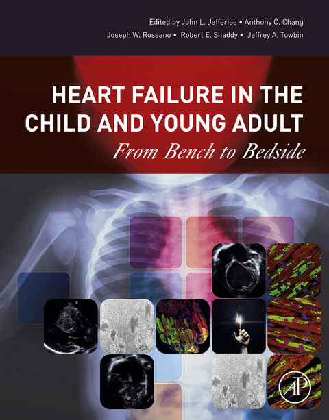 Heart Failure in the Child and Young Adult - 