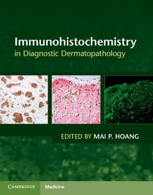 Immunohistochemistry in Diagnostic Dermatopathology - 