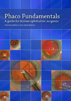 Phaco Fundamentals - Matthew Anderson, Jeremy Butcher